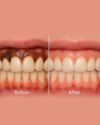 Pediatric Dentistry